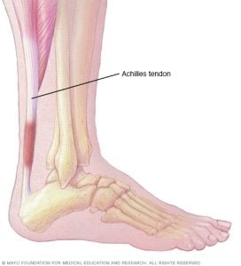 Aşil tendiniti, alt bacağın arkasında baldır kaslarını topuk kemiğine bağlayan doku bandı aşillerin tendonunun aşırı kullanılmış bir yaralanmasıdır.
