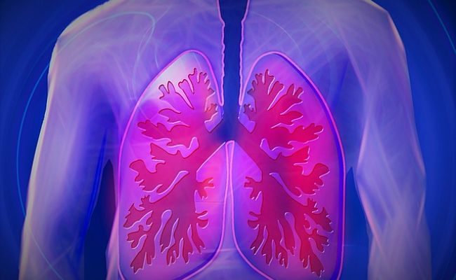 Akciğer-Bronşit