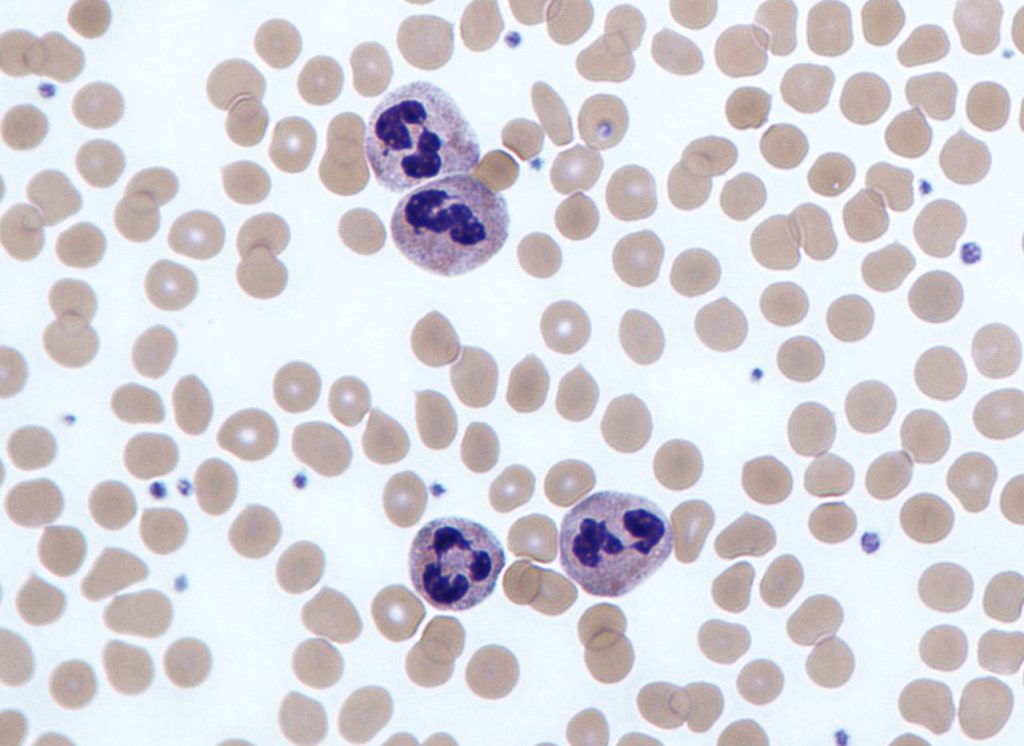 Şekil 4 - Periferik Kan Yaymasında Nötrofiller