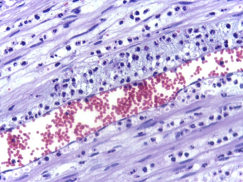 Şekil 2 - Akut inflamasyonda nötrofillerin marjinasyonunu gösteren elektron mikrografı.